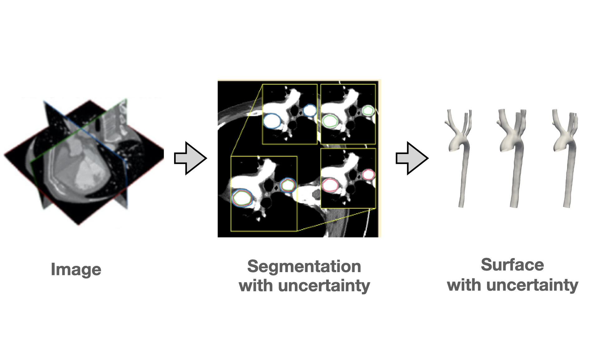 Medical image segmentation pipeline with uncertainty visualization